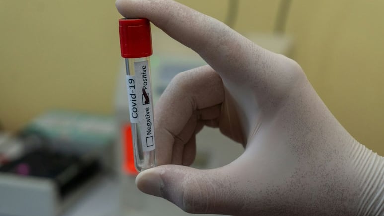 Detectan nueva variante de Covid-19 en Estados Unidos y vinculada con el repunte de contagios en China